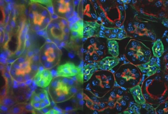 Widefield (left) versus Deconvolved (right) images of a mouse kidney slice, imaged on a Zeiss AxioObserver with a 40x/0.85NA objective lens.